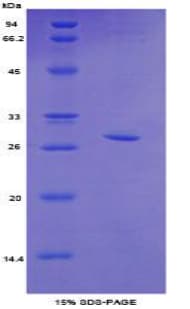 Mouse TOP2B / Topoisomerase II Beta Protein (Recombinant His-T7)