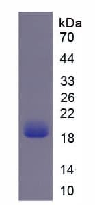Human NOX4 Protein (Recombinant His, N-Terminal)