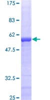 Human ETFA Protein (Recombinant GST)