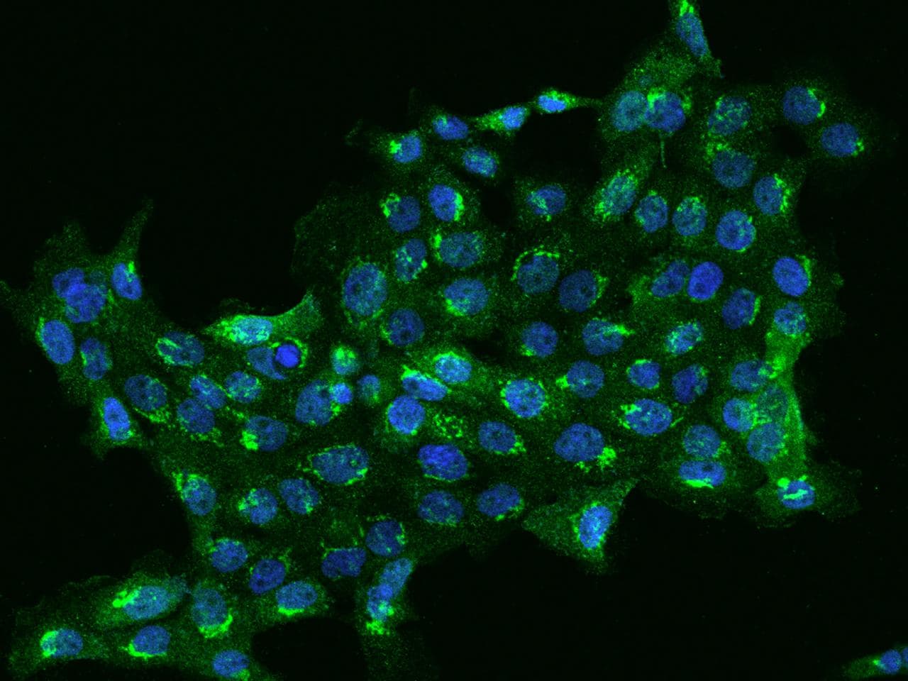 BAD Antibody