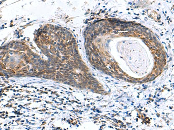 Polyclonal Rabbit anti-Human AP1S3 Antibody (IHC)