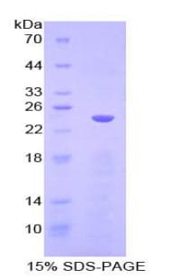 Mouse CD144 / CDH5 / VE Cadherin Protein (Recombinant His-T7)
