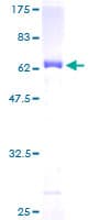 Human GPD1 Protein (Recombinant GST)