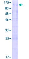 Human ZNF280C / SUHW3 Protein (Recombinant GST)