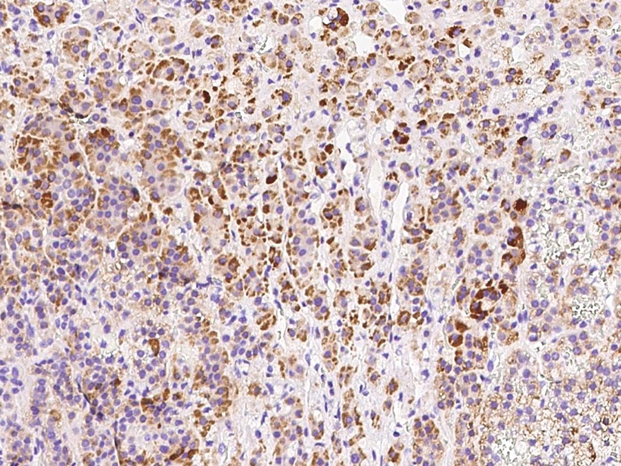 HDHD3 Antibody