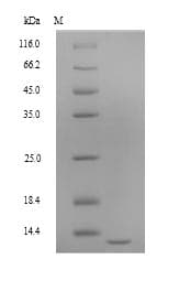 Dictyostelium discoideum ponA Protein (Recombinant 6His, N-terminus)