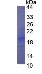 Human IFN Gamma / Interferon Gamma Protein (Recombinant)