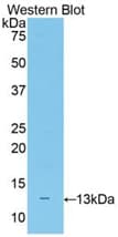 NF-L / NEFL Antibody (aa139-234)