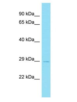 FAM156B Antibody (aa50-99)
