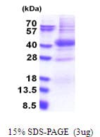 Human PIM2 / Pim-2 Protein (Recombinant His)