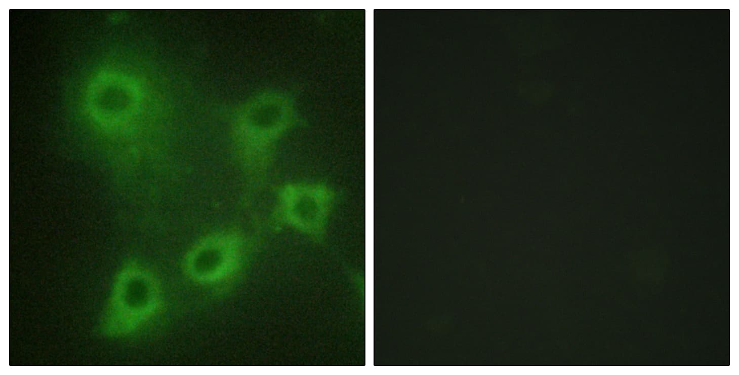 SYK Antibody (aa289-338)