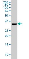 Monoclonal Mouse anti-Human PDHB Antibody (clone 2B2, IHC, WB)