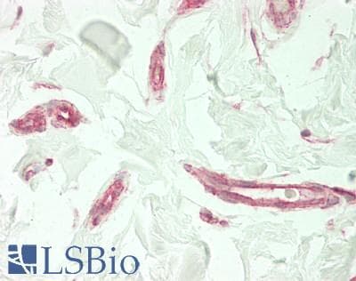IHC-plus™ KDR / VEGFR2 / FLK1 Antibody (aa 20-764)