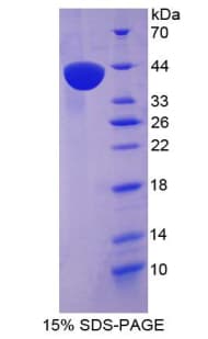 Human CCL3 / MIP-1-Alpha Protein (Recombinant His-GST)