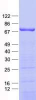 Human ZNF549 Protein (Recombinant His, N-Terminal)