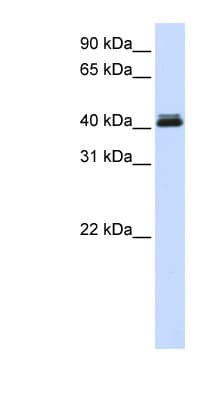 CANT1 Antibody (aa324-373)