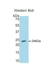 PPARG / PPAR Gamma Antibody (aa280-475)