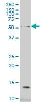Monoclonal Mouse anti-Human ARA70 / NCOA4 Antibody (clone 1F11, IHC, IF, WB)