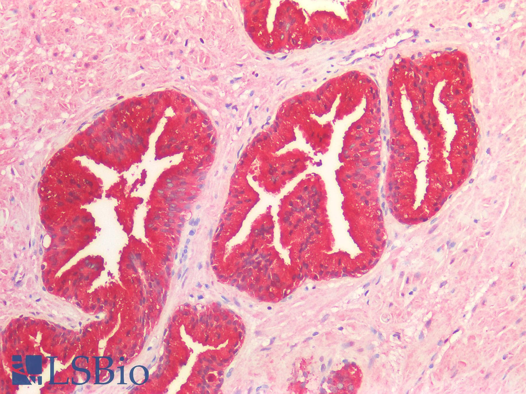 PathPlus™ ACPP / PAP Antibody (aa217-386)