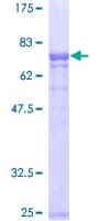 Human SERPINA1 / Alpha 1 Antitrypsin Protein (Recombinant GST)