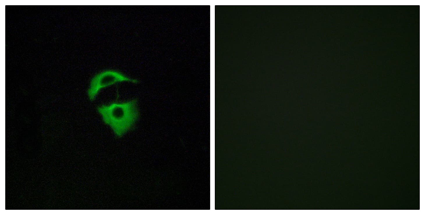 OR2D2 Antibody (aa231-280)