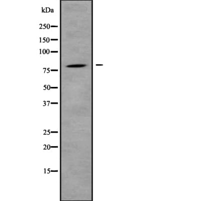 IL31RA Antibody