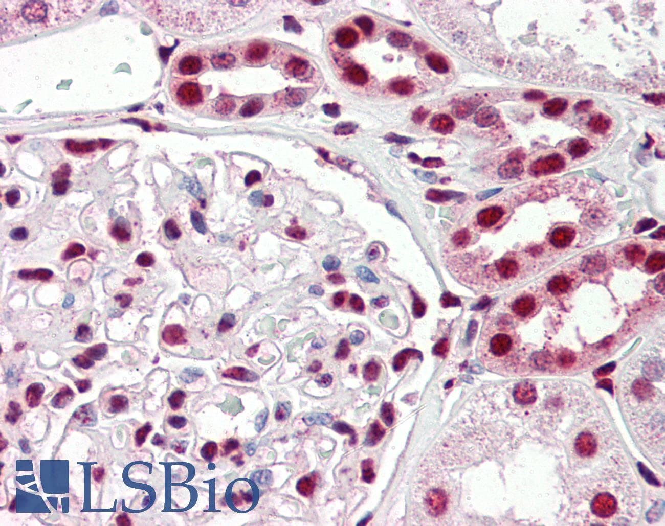 IHC-plus™ Polyclonal Goat anti-Human IRF6 Antibody (aa455-467, IHC, WB)