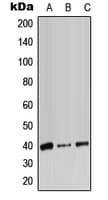 Polyclonal Rabbit anti-Human ADH7 Antibody (Internal, WB)