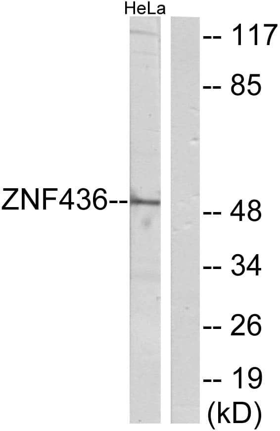 ZNF436 Antibody (aa71-120)