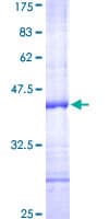 Human CD69 Protein (Recombinant GST, N-terminus)