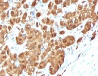 Monoclonal Mouse anti-Human S100B / S100 Beta Antibody (clone PS1B1-1, Azide-free,BSA-free, IHC, IF)