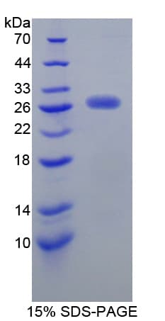 Mouse JAM3 Protein (Recombinant His-T7)