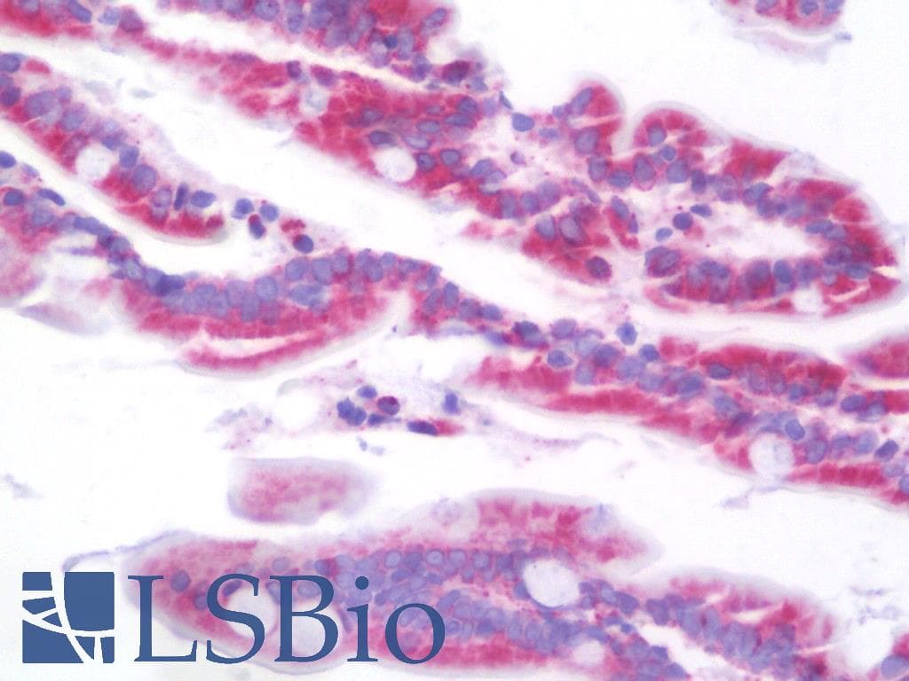 IHC-plus™ SCNN1B / ENaC Beta Antibody (aa306-332)