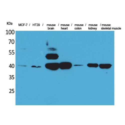 IDH3A Antibody (Internal)
