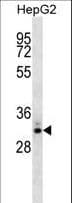 STC2 / Stanniocalcin 2 Antibody