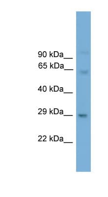 PRRX2 / PRX2 Antibody (N-Terminus)