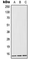 FABP1 / L-FABP Antibody (Internal)