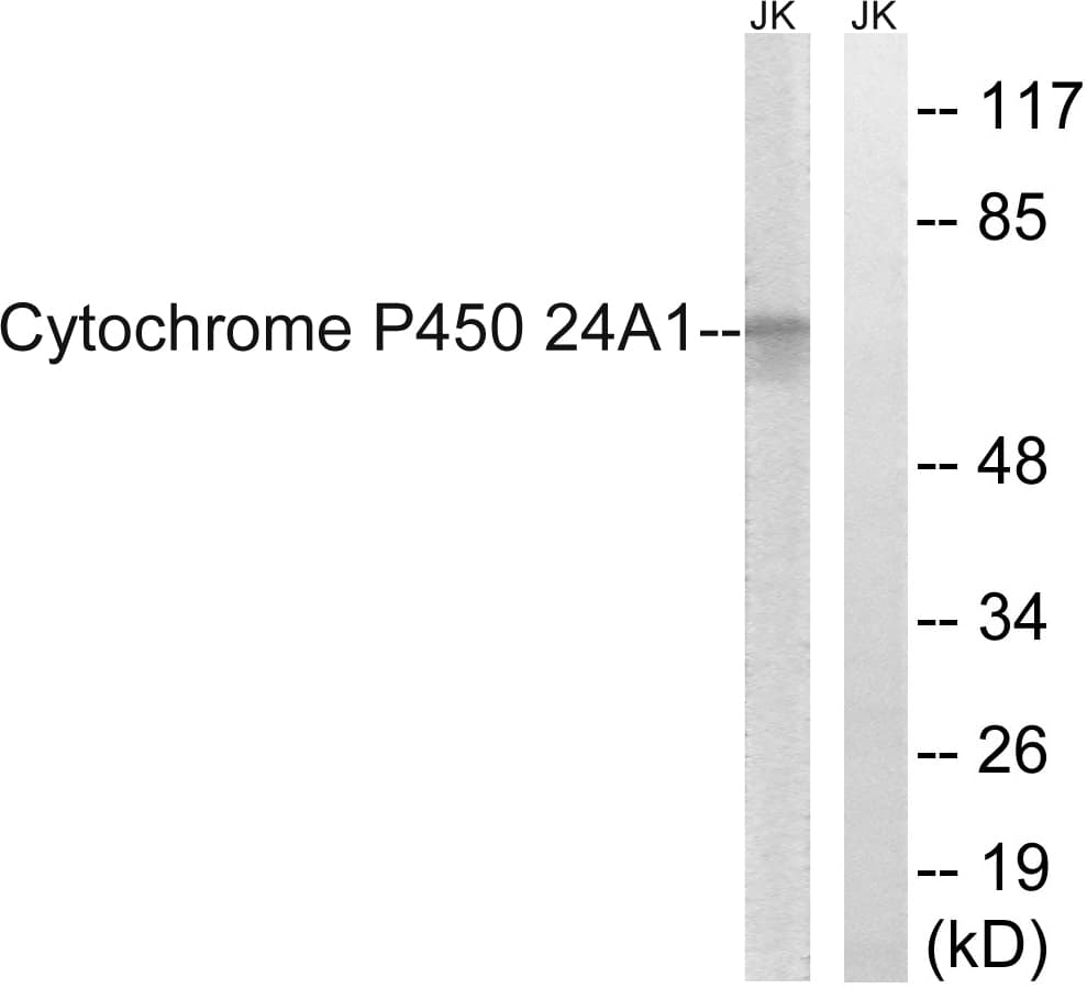 Polyclonal Rabbit anti-Human CYP24 / CYP24A1 Antibody (aa411-460, WB)