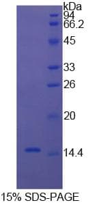 Bovine CST3 / Cystatin C Protein (Recombinant 6His, N-terminus)