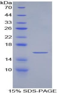 Mouse ARTN / Artemin Protein (Recombinant His, N-Terminal)