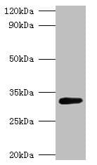 Polyclonal Rabbit anti-E. coli GLS / Glutaminase Antibody (WB)