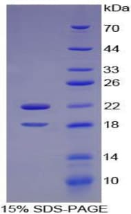 Mouse CSF2RA / CD116 Protein (Recombinant His,N-terminus + GST)