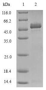 Human TIRAP Protein (Recombinant GST, N-terminus)