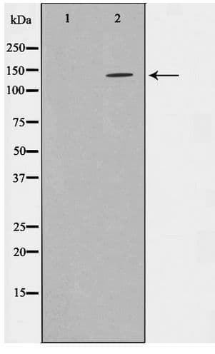 Polyclonal Rabbit anti-Human INPP5D / SHIP1 / SHIP Antibody (WB)