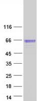Human SERPINF2 / Alpha-2-Antiplasmin Protein (Recombinant Myc-DDK (Flag))