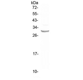 FRA-1 / FOSL1 Antibody