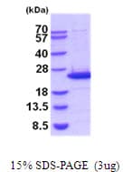 Mouse LCN2 / Lipocalin 2 / NGAL Protein (Recombinant His)