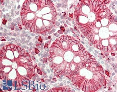 IHC-plus™ EPCAM Antibody (aa217-251)