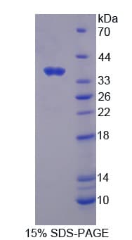 Mouse CASR/Calcium Sensing Receptor Protein (Recombinant His)
