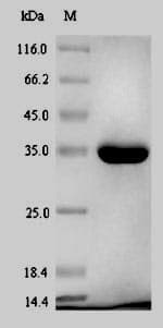 Escherichia coli gmhA Protein (Recombinant 6His-SUMO, N-terminus)